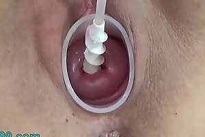 Mummy cervix insertion encircling spiral catheter for insemination together with vibrator jav extreme